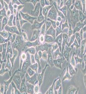 Hela-S3人宮頸癌細(xì)胞主圖