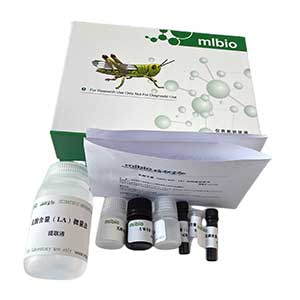 Annexin V-FITC細(xì)胞凋亡檢測試劑盒(TMR紅色熒光)主圖